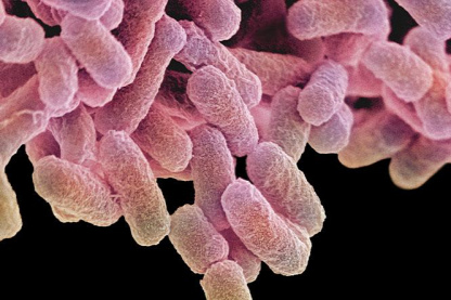 Forrás: AFP/Science Photo Library